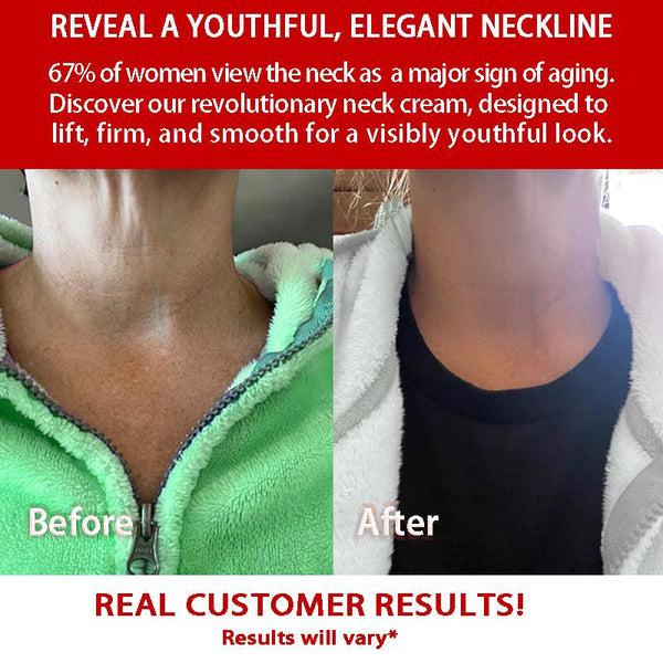 AngeRose Pre-Collagen Peptide Tighten & Lift Neck Cream, Pro-Collagen, Neck Care Flawless Smooth Tightening Comfort for women&men